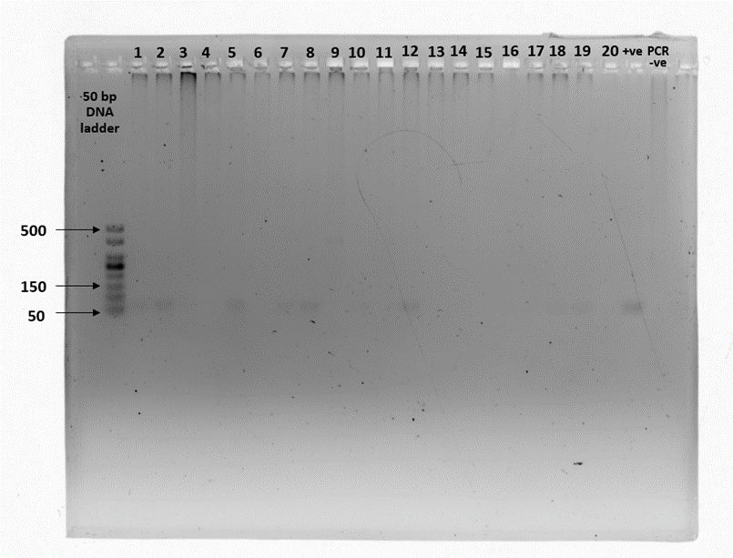 Gel electrophoresis plate described in caption 