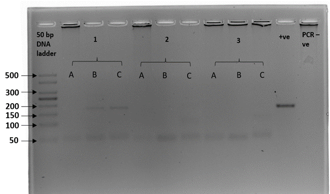 Gel electrophoresis plate described in caption 