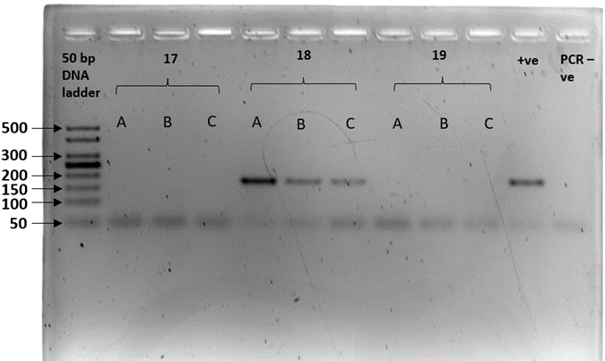 Gel electrophoresis plate described in caption 